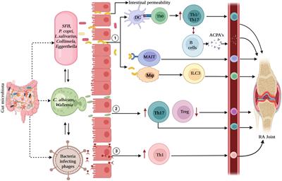 Gut bacteriome, mycobiome and virome alterations in rheumatoid arthritis